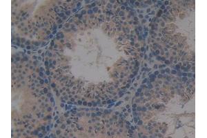 DAB staining on IHC-P; Samples: Mouse Testis Tissue