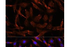 Immunofluorescence analysis of C6 cells using WNT10B Polyclonal Antibody at dilution of 1:100. (WNT10B anticorps)