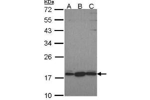 WB Image Sample (30 ug of whole cell lysate) A: Hela B: JurKat C: NT2D1 12% SDS PAGE GNRPX antibody antibody diluted at 1:1000 (GNRPX anticorps  (C-Term))