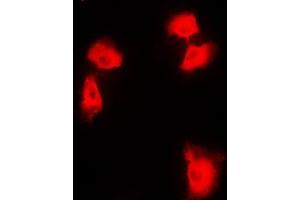 Immunofluorescent analysis of NF-kappaB p100 staining in HEK293T cells. (NFKB2 anticorps  (C-Term))