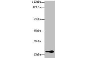 Western blot All lanes: RBBP9 antibody at 1 μg/mL + A375 whole cell lysate Secondary Goat polyclonal to rabbit IgG at 1/10000 dilution Predicted band size: 21, 20 kDa Observed band size: 21 kDa (RBBP9 anticorps  (AA 1-186))