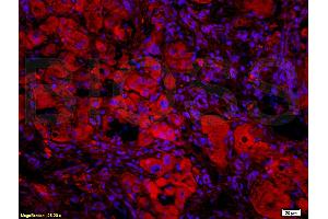 Formalin-fixed and paraffin-embedded: rat liver tissue labeled with Rabbit Anti-BAFF/CD257 Polyclonal Antibody, Unconjugated (ABIN740175) 1:200 followed by conjugation to the secondary Cy3 antibody