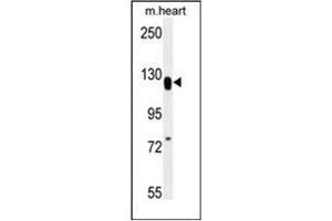 Western blot analysis of MED14 Antibody (Center) in mouse heart tissue lysates (35ug/lane). (MED14 anticorps  (Middle Region))
