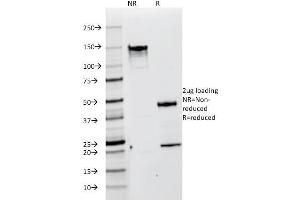 SDS-PAGE Analysis Purified gp100 / Melanosome Monoclonal Antibody (HMB45).