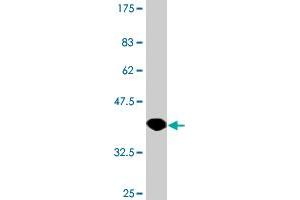 Western Blot detection against Immunogen (37.