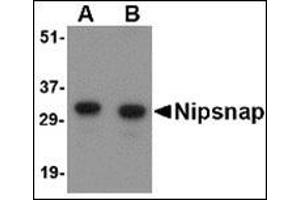 Western blot analysis of NIPSNAP in human brain tissue lysate with this product at (A) 0. (NIPSNAP1 anticorps  (Center))