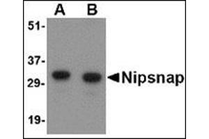 Western blot analysis of NIPSNAP in human brain tissue lysate with this product at (A) 0. (NIPSNAP1 anticorps  (Center))