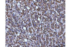 IHC analysis of BBS9 using anti-BBS9 antibody (ABIN7601518). (BBS9 anticorps  (AA 37-793))