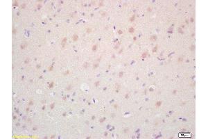 Formalin-fixed and paraffin embedded rat brain labeled with Rabbit Anti TAK1/MAP3K7 Polyclonal Antibody, Unconjugated  at 1:200 followed by conjugation to the secondary antibody and DAB staining