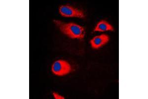 Immunofluorescent analysis of RPS9 staining in Jurkat cells. (RPS9 anticorps  (Center))