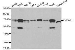 Western blot analysis of extracts of various cell lines, using IGF2BP1 antibody.
