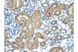 anti-tRNA Nucleotidyl Transferase, CCA-Adding, 1 (Trnt1) (AA 75-124) antibody