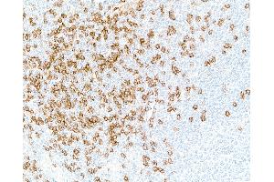 Immunohistochemistry (IHC) image for anti-CD8a Molecule (CD8A) (AA 22-180) antibody (ABIN7449371) (Recombinant CD8 alpha anticorps  (AA 22-180))