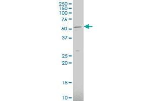 SLC2A9 polyclonal antibody (A01), Lot # 060623JCS1 Western Blot analysis of SLC2A9 expression in HeLa .