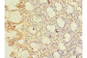 anti-CWF19-Like 1, Cell Cycle Control (CWF19L1) (AA 101-330) antibody