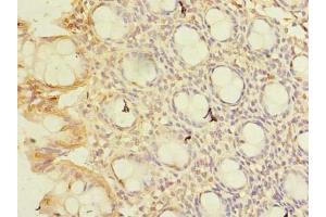Immunohistochemistry of paraffin-embedded human colon tissue using ABIN7148768 at dilution of 1:100 (CWF19L1 anticorps  (AA 101-330))