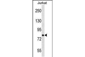 Western blot analysis in Jurkat cell line lysates (35ug/lane). (CACNB2 anticorps  (AA 232-261))