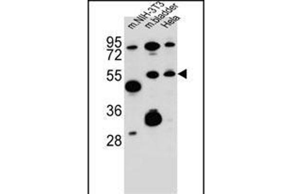 SMOC1 Antikörper  (C-Term)