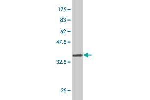 Western Blot detection against Immunogen (32.