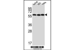 Western blot analysis of UTP6 Antibody in Jurkat,293,Hela cell line lysates (35ug/lane) (UTP6 anticorps  (N-Term))