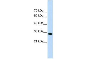 ADAMTS4 antibody used at 0.