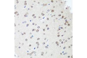 Immunohistochemistry of paraffin-embedded rat brain using SAP18 antibody at dilution of 1:100 (40x lens). (SAP18 anticorps)