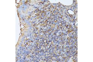Immunohistochemistry of paraffin-embedded rat lung using STK24 antibody (ABIN6132364, ABIN6148602, ABIN6148603 and ABIN6214875) at dilution of 1:100 (40x lens). (STK24 anticorps  (AA 312-431))