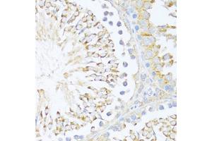 Immunohistochemistry of paraffin-embedded rat testis using DDX3Y antibody (ABIN6130260, ABIN6139496, ABIN6139497 and ABIN6215395) at dilution of 1:100 (40x lens). (DDX3Y anticorps  (AA 1-210))