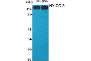 Western Blot (WB) analysis of specific cells using NY-CO-9 Polyclonal Antibody.