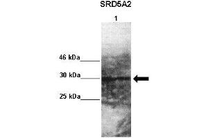 Lanes : Lane 1: 50ug monkey brain extract  Primary Antibody Dilution :  1:1000   Secondary Antibody : Goat anti rabbit-HRP  Secondary Antibody Dilution :  1:10,000  Gene Name : SRD5A2  Submitted by : Jonathan Bertin, Endoceutics Inc. (SRD5A2 anticorps  (N-Term))