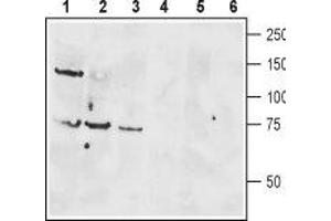 Western blot analysis of rat brain lysate (lanes 1 and 4), mouse brain membranes (lanes 2 and 5) and human Jurkat T cell leukemia cell lysate (lanes 3 and 6): - 1-3. (VIPR1 anticorps  (Extracellular, N-Term))