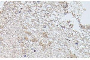 Immunohistochemistry of paraffin-embedded Rat brain using PPP2R5D Polyclonal Antibody at dilution of 1:100 (40x lens). (PPP2R5D anticorps)