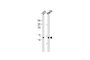 Western blot analysis of lysates from 293,Hela cell line (from left to right),using MRPL14 Antibody (ABIN6241786). (MRPL14 anticorps)
