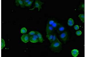 Immunofluorescent analysis of MCF-7 cells using ABIN7153175 at dilution of 1:100 and Alexa Fluor 488-congugated AffiniPure Goat Anti-Rabbit IgG(H+L) (FZD1 anticorps  (AA 73-322))