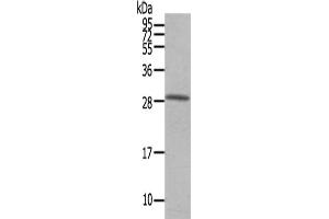 Gel: 12 % SDS-PAGE,Lysate: 40 μg,Primary antibody: ABIN7191746(OSM Antibody) at dilution 1/200 dilution,Secondary antibody: Goat anti rabbit IgG at 1/8000 dilution,Exposure time: 40 seconds (Oncostatin M anticorps)