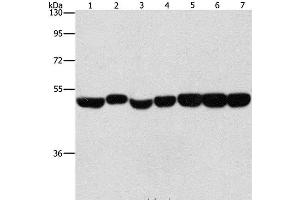 Western Blot analysis of Hela, A431 and hepG2 cell, Mouse brain and liver tissue, Mouse pancreas and Human fetal brain tissue using ENO1 Polyclonal Antibody at dilution of 1:700 (ENO1 anticorps)