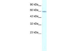 Human Jurkat; WB Suggested Anti-ZNF543 Antibody Titration: 0. (ZNF543 anticorps  (Middle Region))