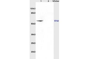 Lane 1: rat brain lysates Lane 2: rat kidney lysates probed with Anti CK4 Polyclonal Antibody, Unconjugated (ABIN730828) at 1:200 in 4 °C.