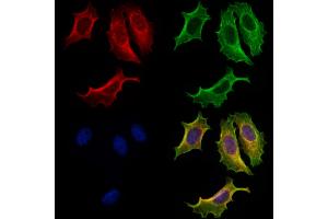ABIN7094811 and ABIN7098862 staining Hela cells by IF/ICC. (Apolipoprotein M anticorps  (Internal Region))