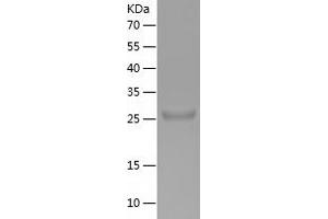 Western Blotting (WB) image for Thrombospondin 1 (THBS1) (AA 19-265) protein (His tag) (ABIN7125377)