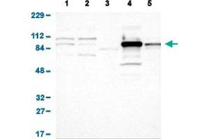 Western Blot analysis of (1) human cell line RT-4 (2) human cell line U-251MG sp (3) human plasma (IgG/HSA depleted) (4) human liver tissue, and (5) human tonsil tissue. (Glucose-6-Phosphate Dehydrogenase anticorps  (AA 43-154))