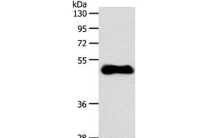 Western Blot analysis of Human fetal brain tissue using EDG3 Polyclonal Antibody at dilution of 1:700 (S1PR3 anticorps)