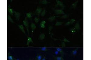 Immunofluorescence analysis of C6 cells using ZWINT Polyclonal Antibody at dilution of 1:100 (40x lens).