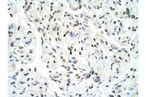 SFPQ antibody was used for immunohistochemistry at a concentration of 4-8 ug/ml to stain Skeletal muscle cells (arrows) in Human Muscle.