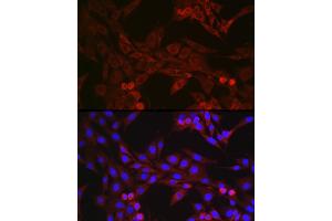 anti-Gasdermin D (GSDMD) (AA 276-484) antibody