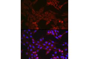 Immunofluorescence analysis of NIH/3T3 cells using GSDMD (Full Length+C terminal) Rabbit pAb (ABIN7267350) at dilution of 1:250 (40x lens). (GSDMD anticorps  (AA 276-484))
