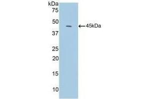 Detection of Recombinant C3c, Mouse using Polyclonal Antibody to Complement C3 Convertase (C3 Convertase) (Complement C3 Convertase anticorps)