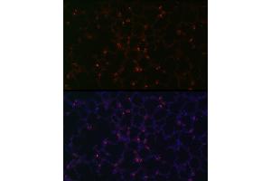 Immunofluorescence analysis of mouse lung using SFTPC Rabbit pAb (ABIN3015597, ABIN3015598, ABIN3015599, ABIN1682683 and ABIN6218961) at dilution of 1:100 (40x lens).