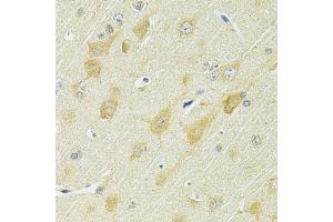 Immunohistochemistry of paraffin-embedded rat brain using SLC25A1 antibody (ABIN5998842) at dilution of 1/100 (40x lens). (Slc25a1 anticorps)