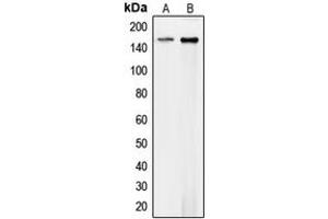 Western blot analysis of Collagen 4 alpha 1 expression in HEK293T (A), mouse endothelial (B) whole cell lysates.